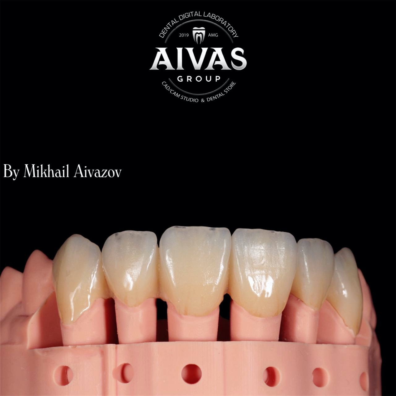 aivas-dent11
