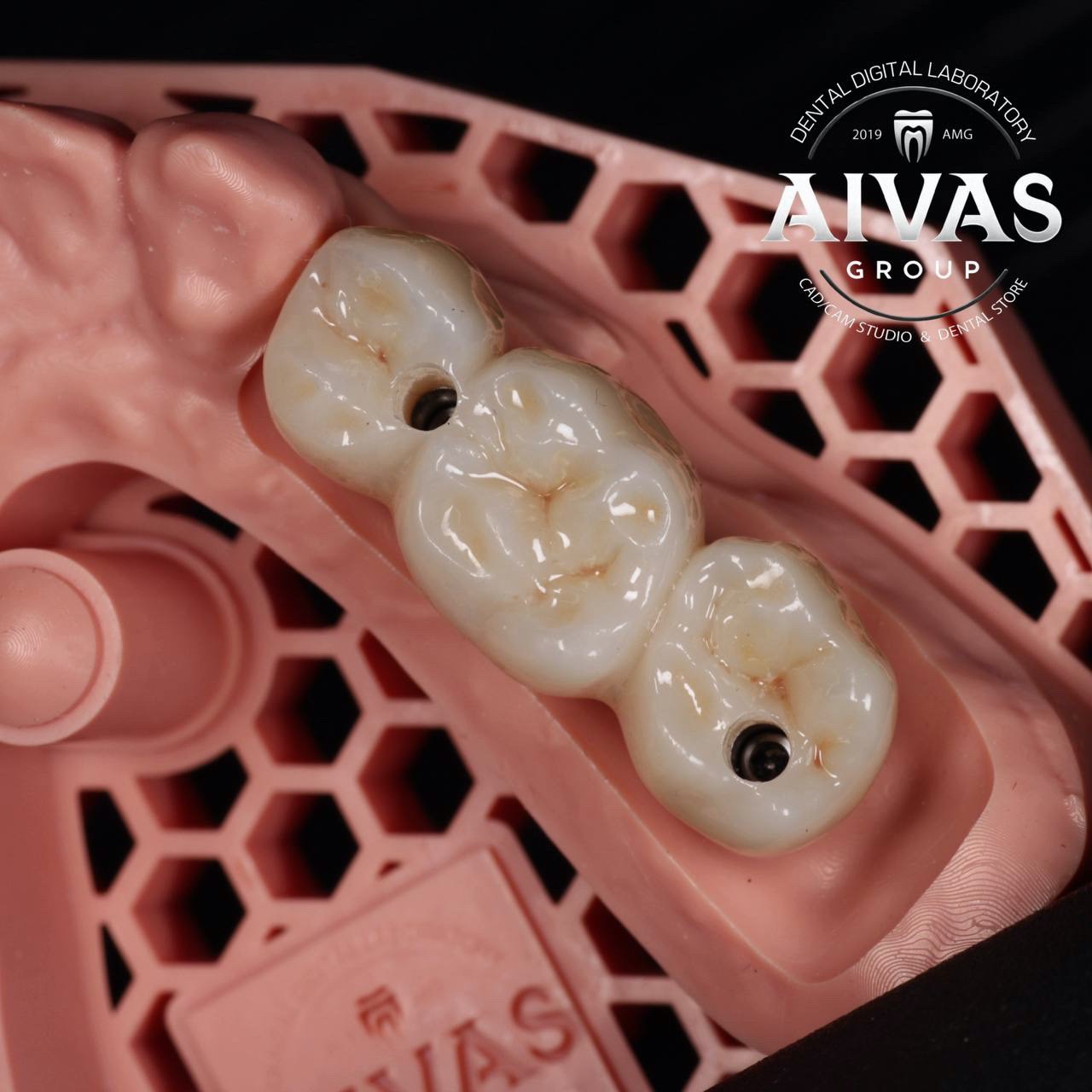 aivas-dent25