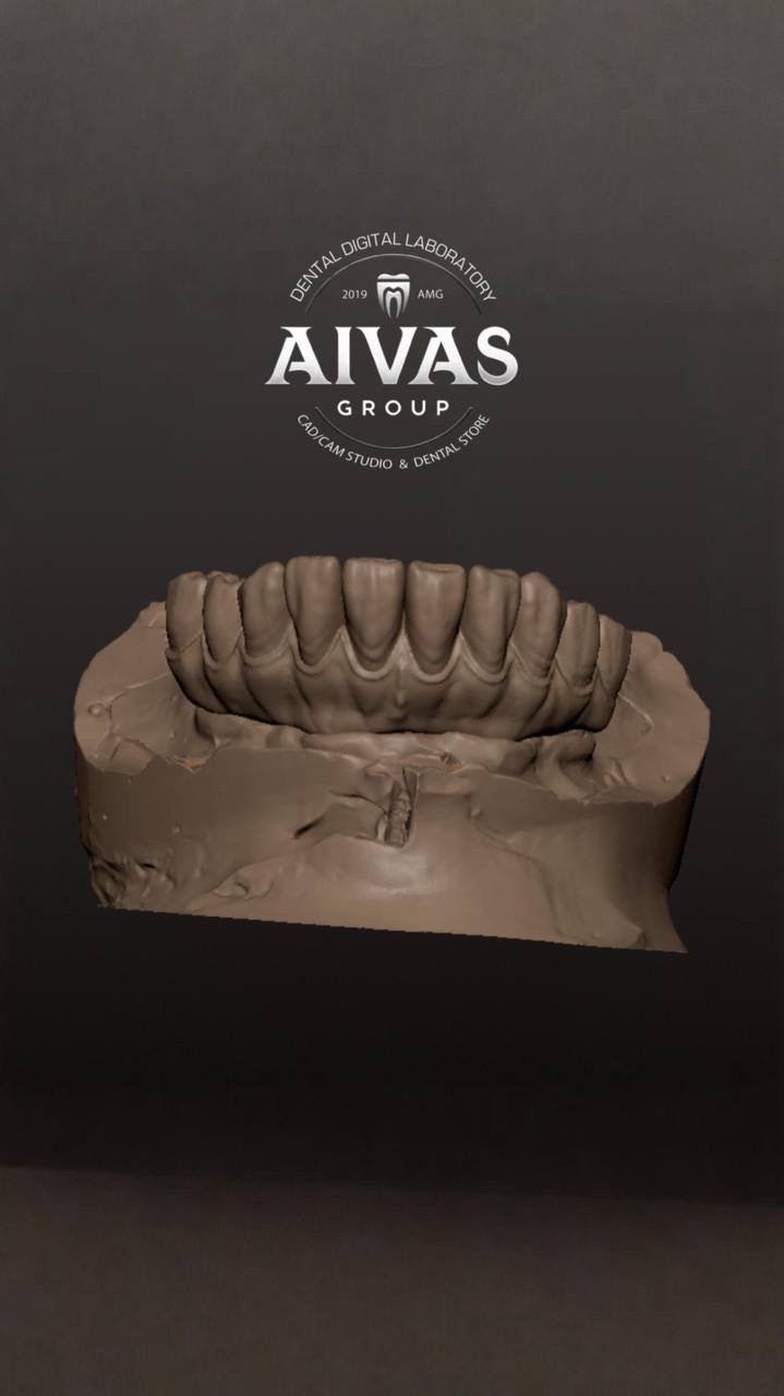 aivas-dent32