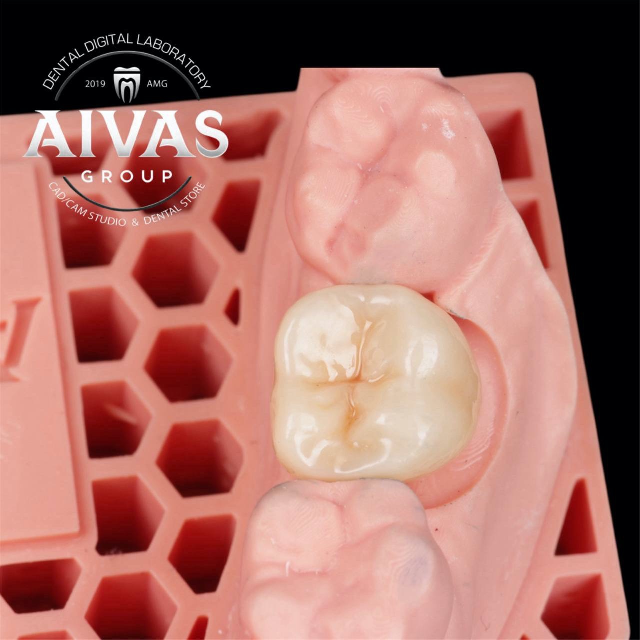 aivas-dent34
