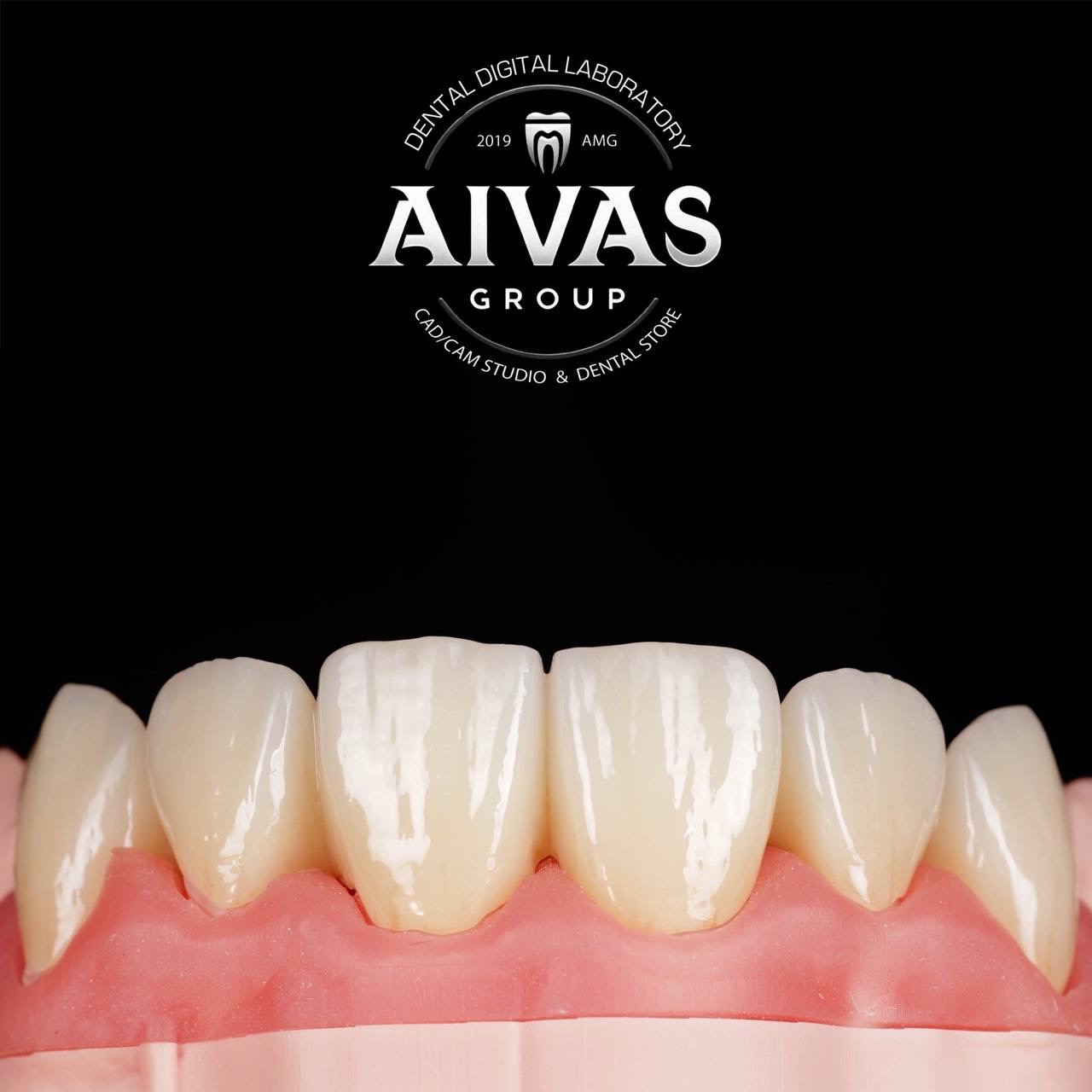 aivas-dent36