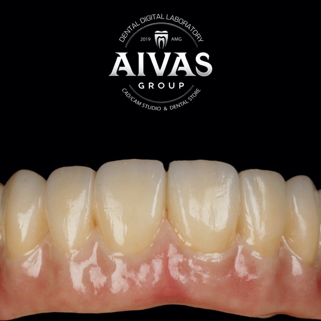 aivas-dent39