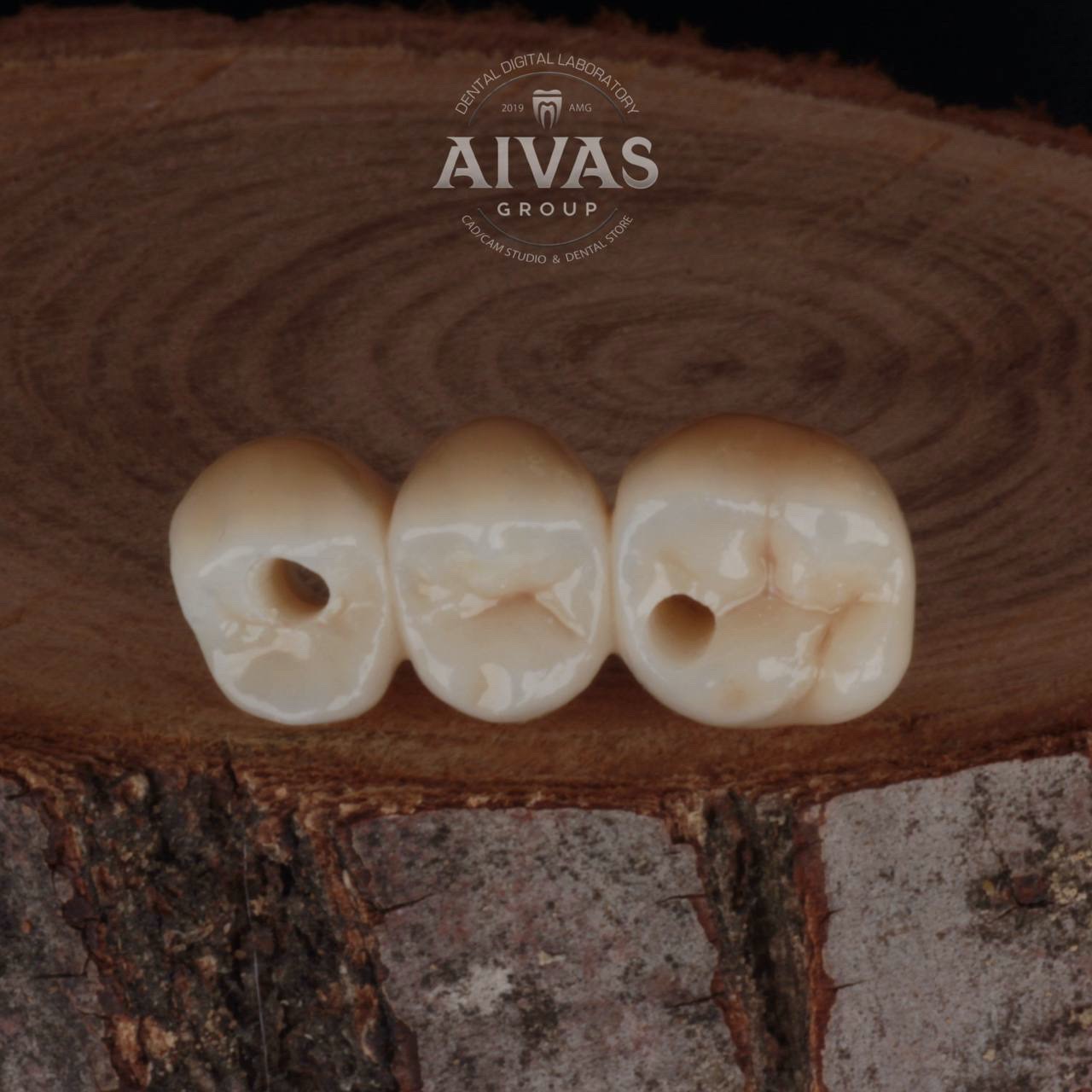 aivas-dent4