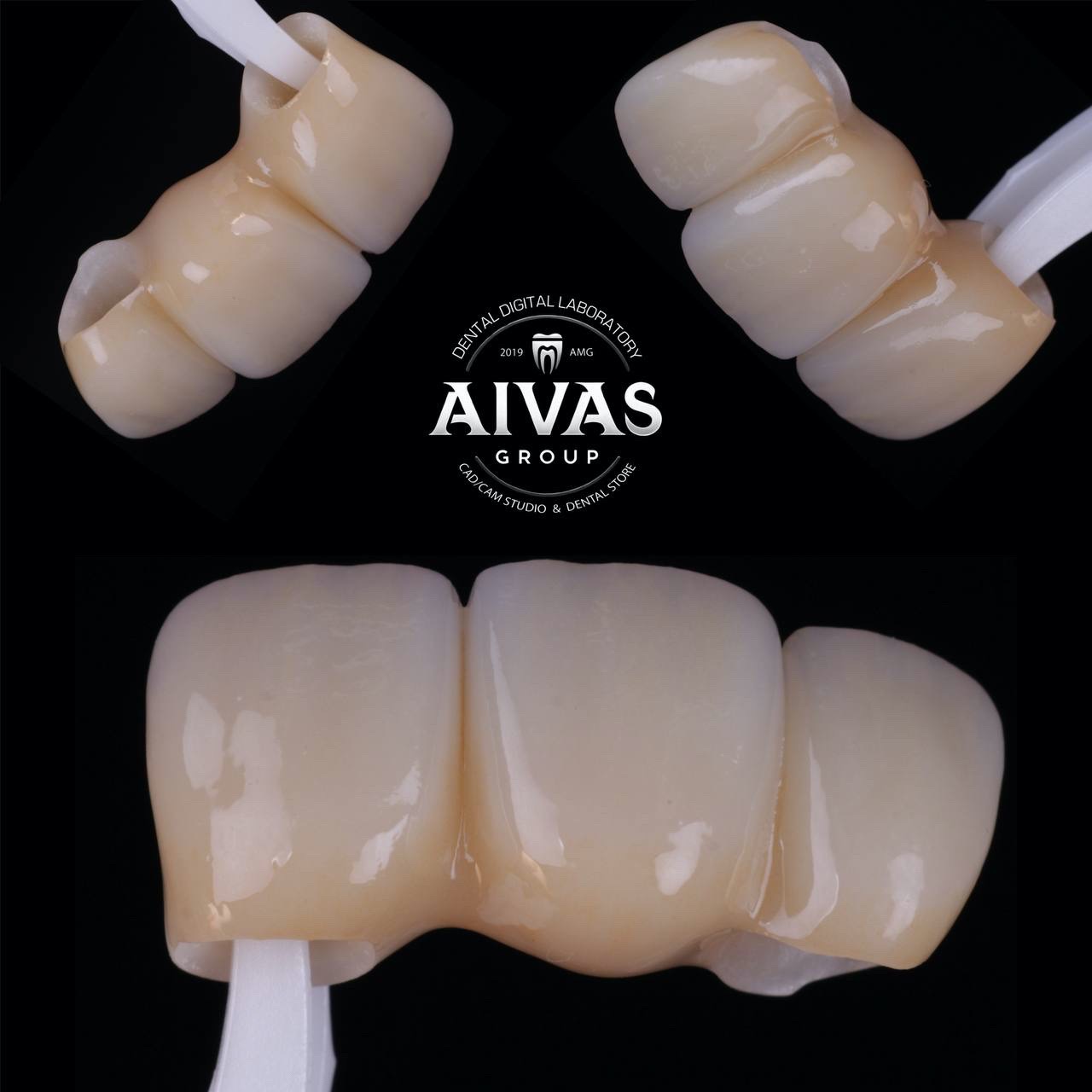 aivas-dent44