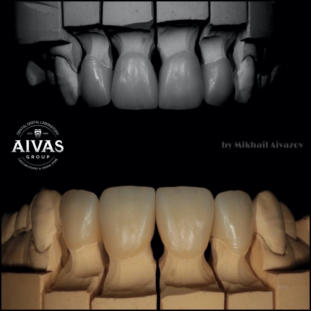 aivas-dent49