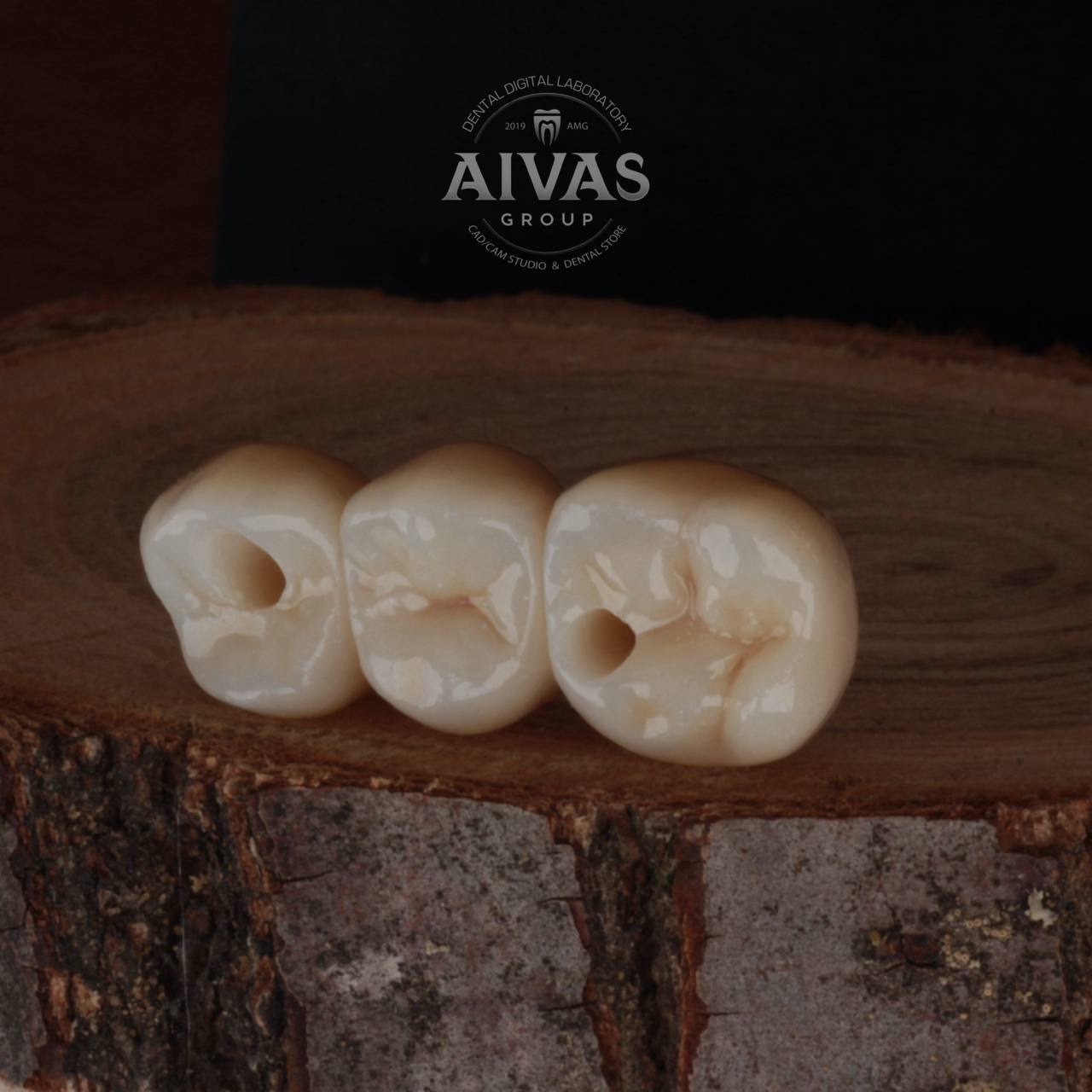 aivas-dent5